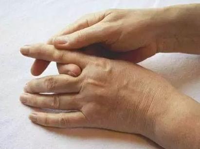 손가락마디통증